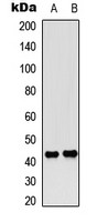 CREB (phospho Ser142) antibody
