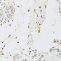 USP7 antibody