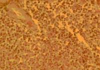 CCR4 antibody