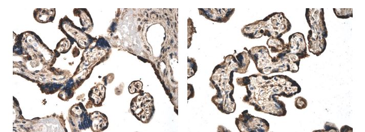 Activin Receptor Type IIB antibody [6L11]