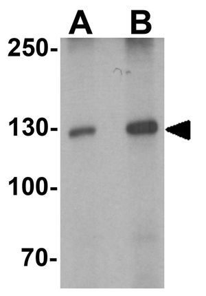 TYK2 antibody
