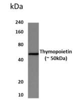LAP2 antibody [8S37]