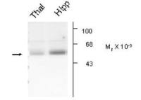 GABA A Receptor alpha 5 antibody