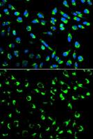 14-3-3 sigma antibody