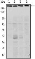RICTOR antibody [4H5]