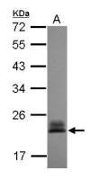 RhoC antibody