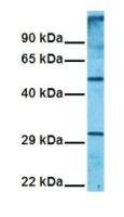 SLC1A5 antibody, Internal