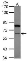 ZNF449 antibody