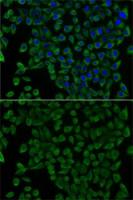 Transcobalamin II antibody