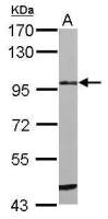 Matriptase / ST14 antibody