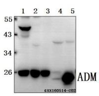 Adrenomedullin antibody