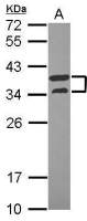 V-ATPase D antibody