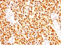 Myogenin antibody [SPM144]