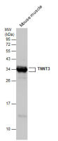 Troponin T fast skeletal antibody