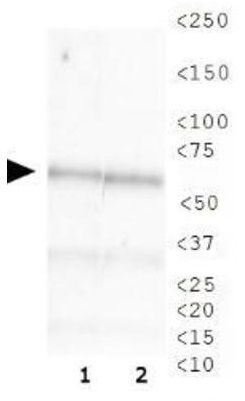 CHAF1B antibody [SS 24 1-68]