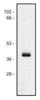 HLA Class I antibody [MEM-147]