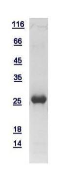 Human PHD3 protein, His tag