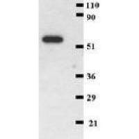 CD41 antibody [MEM-06]