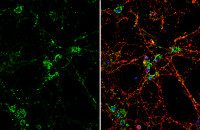DKK3 antibody [N2C3]