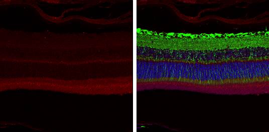 ABCA4 antibody [C3-2], C-term