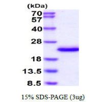 Human IL1F9 protein, His tag