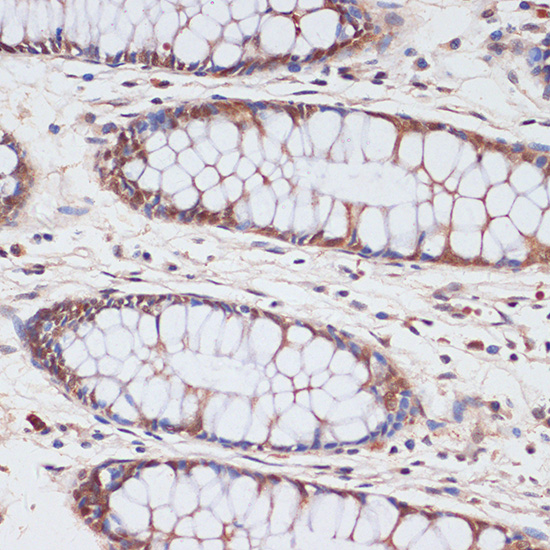 CDKN2A / p16INK4a antibody