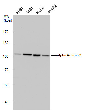 alpha Actinin 3 antibody