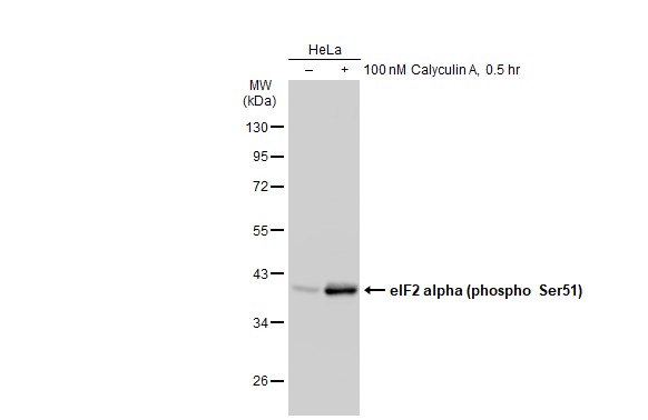 eIF2 alpha (phospho Ser51) antibody [GT1203]