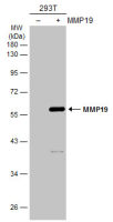 MMP19 antibody