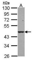 M/NEI antibody [N2C3]