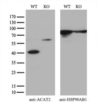 ACAT2 antibody [3C9]