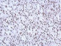SMNDC1 antibody [N1C3-2]