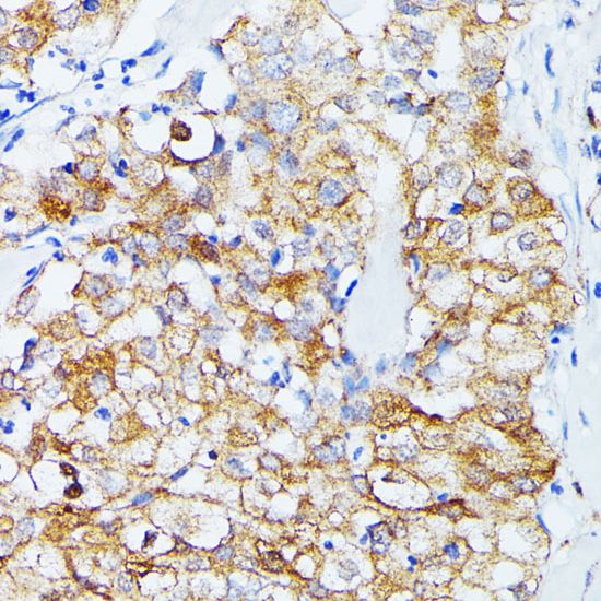 ECE1 antibody