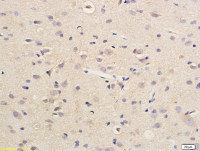 SDHD antibody