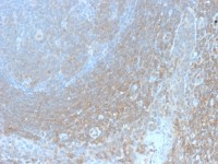 BCL10 antibody [BL10/2988R]