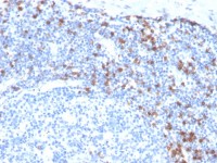 Integrin alpha E antibody [ITGAE/3904R]