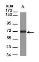 CCDC6 antibody