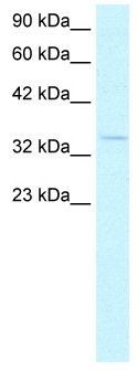 HEY1 antibody, C-term