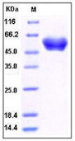 Human alpha 1 Antitrypsin protein, His tag (active)
