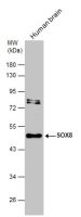 SOX8 antibody