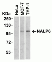 NALP6 antibody