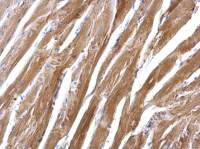 SGCE antibody [N1C1]