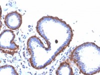 Ferritin Light Chain antibody [FTL/3872R]