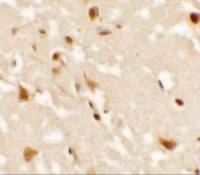 AIG1 antibody