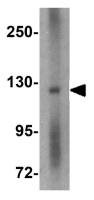 RIM2 antibody