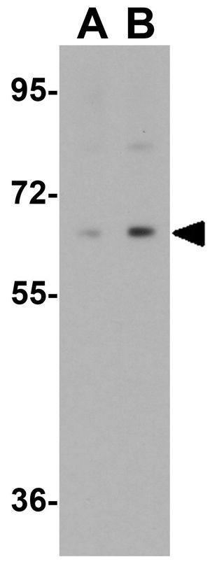 IRF2BP2 antibody