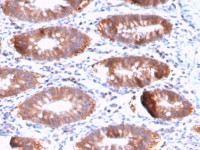 Aurora B antibody [AURKB/3121R]