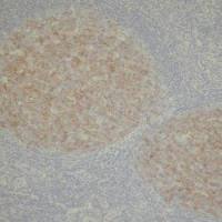 CD10 antibody [56C6]