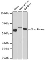 Glucokinase antibody [GT1266]