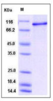 Human STAT6 protein, His tag
